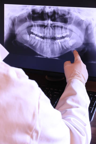 Best Emergency Dentist for Knocked-Out Tooth in Cary, IL