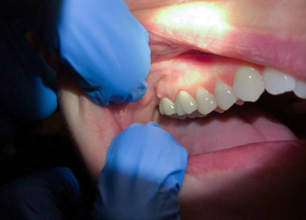 Best Urgent Dental Care for Toothache in Cary, IL