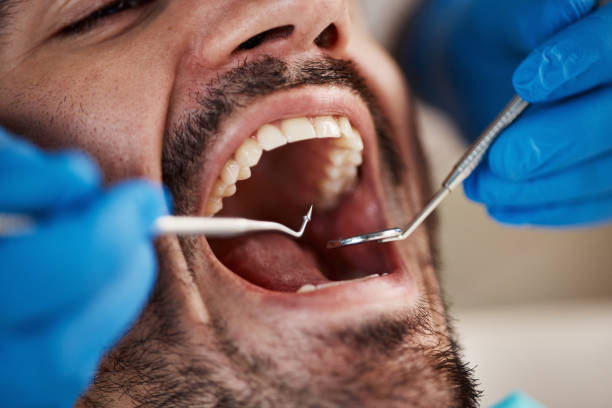Best Weekend Emergency Dentist in Cary, IL